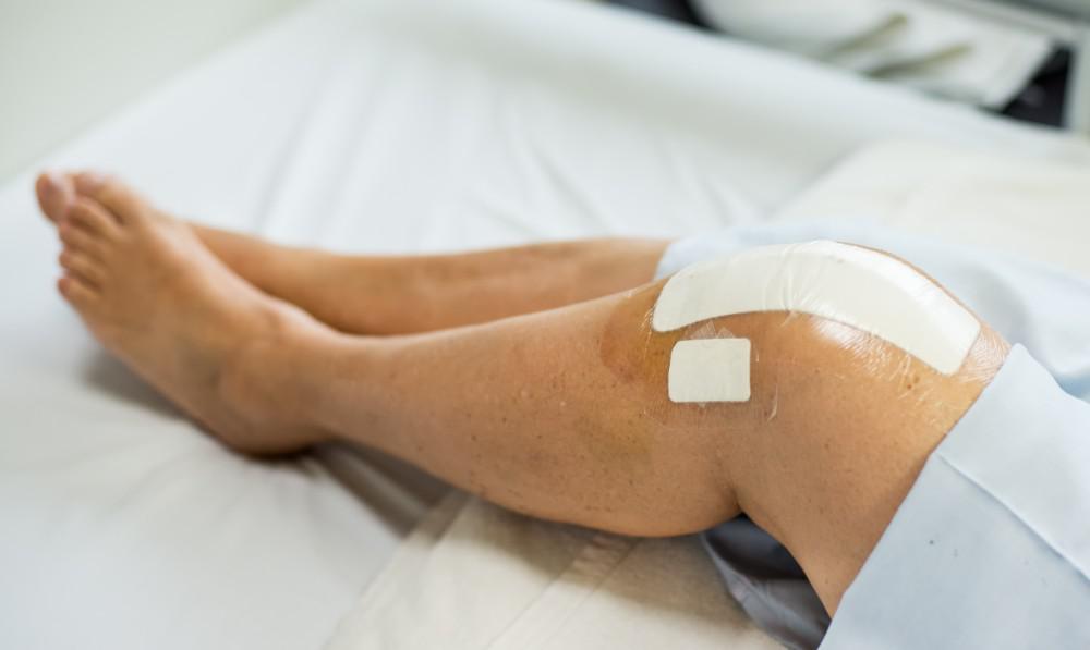 5 Effective Tips To Help Speed  Your Recovery After a knee Replacement Surgery.
