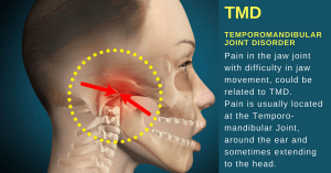TMD: Causes, Symptoms, and Effective Physical Therapy Treatment.